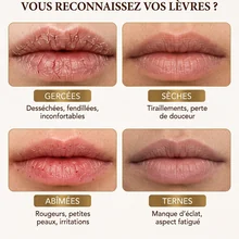 Élixir Soin Lèvres — types de lèvres concernées